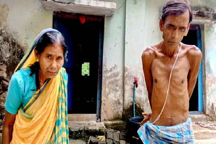 Deformed bodies & yellowing teeth: Fluoride contamination in water major health hazard in rural Jharkhand